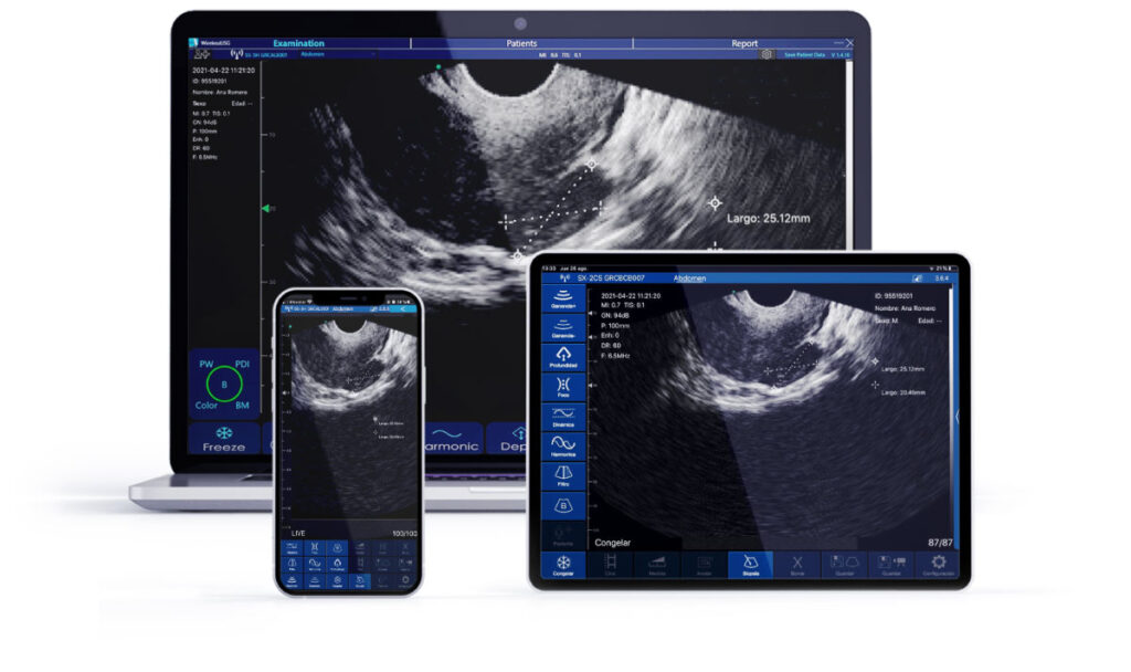 Ecógrafo Transvaginal Portátil Sonostar | El Panta